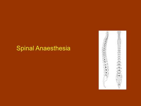 Spinal Anaesthesia.