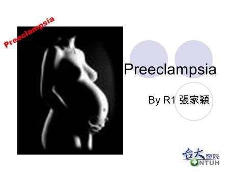 Preeclampsia By R1 張家穎 Preeclampsia. Introduction Preeclampsia complicates up to 8% of pregnancies. Classic triad : hypertension, proteinuria and edema.