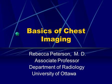 Basics of Chest Imaging