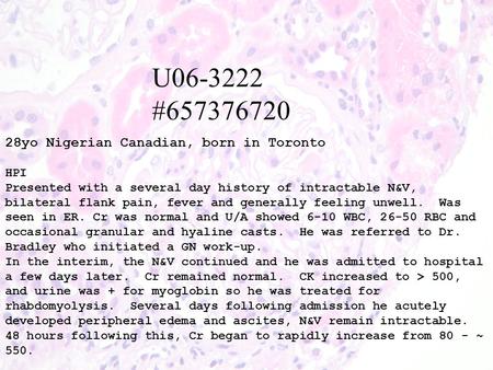 U06-3222 #657376720 28yo Nigerian Canadian, born in Toronto HPI Presented with a several day history of intractable N&V, bilateral flank pain, fever and.