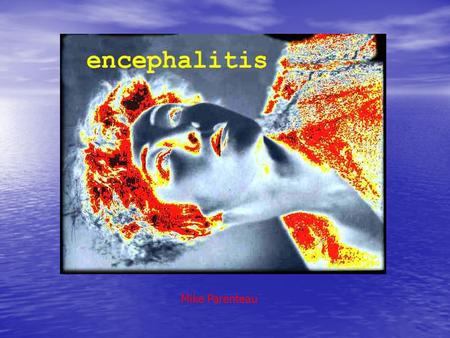 Mike Parenteau. Etiology / Pathophysiology Encephalitis is an acute inflammation of the brain, commonly caused by a viral infection. Sometimes, encephalitis.