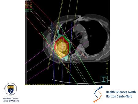 Conflict of Interest Declaration: Nothing to Disclose Presenter: Sophie Lamoureux Title of Presentation: A Comparison of Stereotactic Body Radiotherapy.