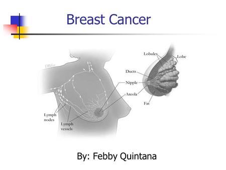 Breast Cancer By: Febby Quintana. Symptoms for Breast Cancer A lump or thickening on or near breast Any change on size or shape of breast Change in color.