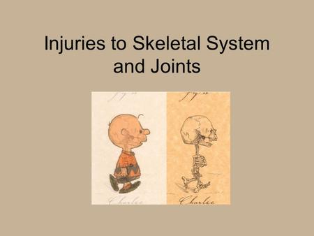 Injuries to Skeletal System and Joints. Classification of Bones Long –femur, humerus Short –carpals, tarsals Flat –frontal, sternum Irregular –vertebral.