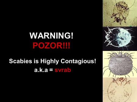 Scabies is Highly Contagious! a.k.a = svrab