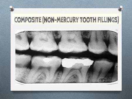 O (white fillings) (non- mercury fillings) O a tooth colored mixture of acrylic resin and ceramic filler particles. O was introduced in 1960s.