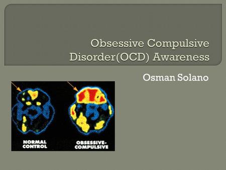 Osman Solano.  Obsessive Compulsive Disorder is an anxiety disorder. It creates an awareness of alarm or threat to the person. The person typically tries.