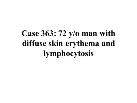 Case 363: 72 y/o man with diffuse skin erythema and lymphocytosis.