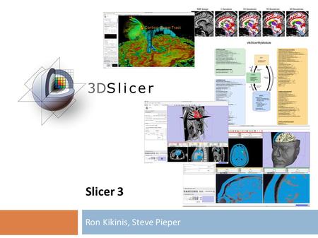 Slicer 3 Ron Kikinis, Steve Pieper. CTK Workshop Heidelberg, June 29/30, 2009 Slicer Goals  Stable, Usable, Cross Platform, End-User Software for Medical.