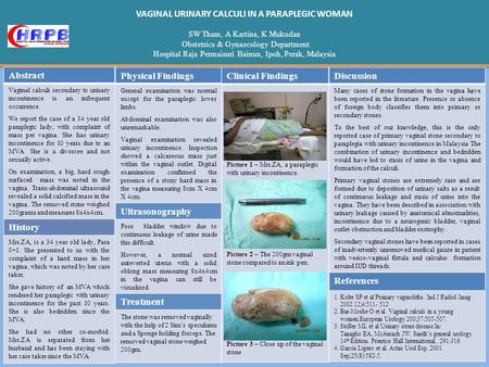 VAGINAL URINARY CALCULI IN A PARAPLEGIC WOMAN SW Tham, A Kartina, K Mukudan Obstetrics & Gynaecology Department Hospital Raja Permaisuri Bainun, Ipoh,