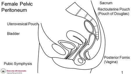 Female Pelvic Peritoneum