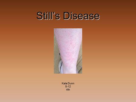 Still’s Disease Kala Dunn 5-12 4th.