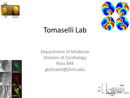 Tomaselli Lab Department of Medicine Division of Cardiology Ross 844 GFP-LC3 Cx43 MERGE 5 mm WTIQ/AA 1 sec 0 WT IQ/AA IQ/AA + Ranol.