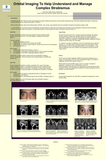 Orbital Imaging To Help Understand and Manage Complex Strabismus Introduction Multipositional MRI [M-P MRI] can clarify some aspects of complex strabismus.