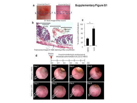 D Day 2Day 1Day 4Day 6 Day 1 Day 2 Day 4 Day 6 Biopsy Injury D0 D1 D2 D3 D4 D5 D6 Wound monitoring by endoscope & Intrarectal adminstration of LGG or HBSS.