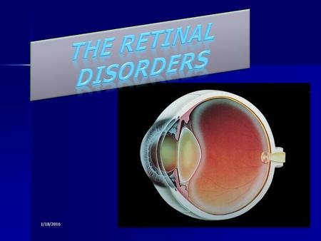 The Retinal Disorders 4/26/2017.