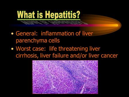 What is Hepatitis? General: inflammation of liver parenchyma cells