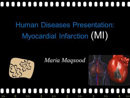 >>0 >>1 >> 2 >> 3 >> 4 >> Human Diseases Presentation: Myocardial Infarction (MI) Maria Maqsood.