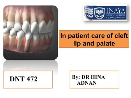 In patient care of cleft lip and palate By: DR HINA ADNAN DNT 472.