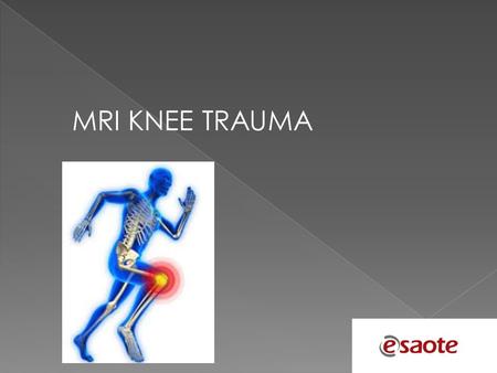 MRI KNEE TRAUMA.