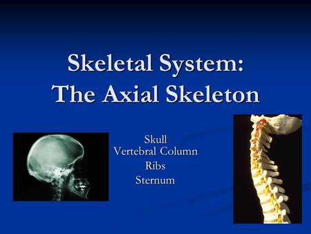 Skeletal System: The Axial Skeleton