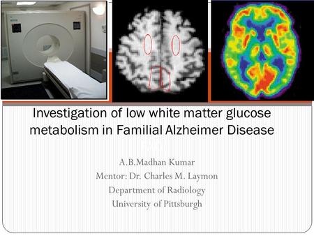 A.B.Madhan Kumar Mentor: Dr. Charles M. Laymon Department of Radiology