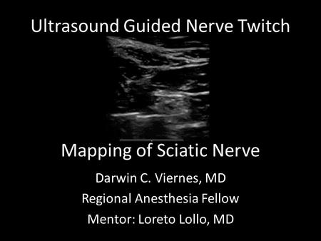 Ultrasound Guided Nerve Twitch Darwin C. Viernes, MD Regional Anesthesia Fellow Mentor: Loreto Lollo, MD Mapping of Sciatic Nerve.