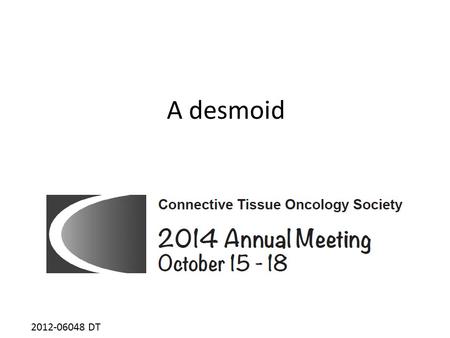 A desmoid 2012-06048 DT. April 2012 2010-15313 TM 29 year-old woman No past history Right parietal mass increasing in size for 5 months 2012-06048 DT.