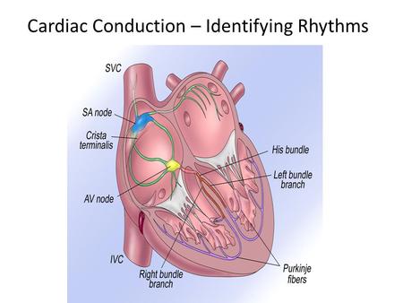 Cardiac Conduction – Identifying Rhythms.