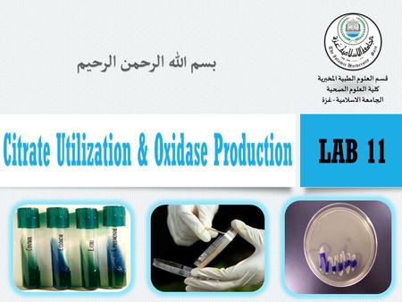 Citrate Utilization Tests for the ability of bacteria to convert citrate (an intermediate of the Krebs cycle) into oxaloacetate (another intermediate.