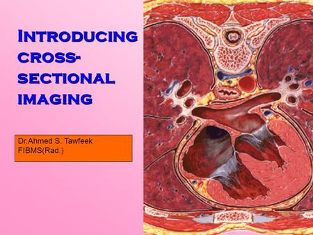 Introducing cross- sectional imaging Dr.Ahmed S. Tawfeek FIBMS(Rad.)