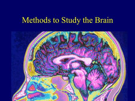 Methods to Study the Brain. The Brain How do we learn about the brain & its functions?