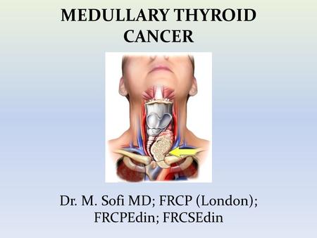 MEDULLARY THYROID CANCER