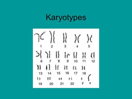 Karyotypes. What is a karyotype? A karyotype is made from a picture of the nucleus of a cell which has begun to undergo mitosis. Mitosis is the process.