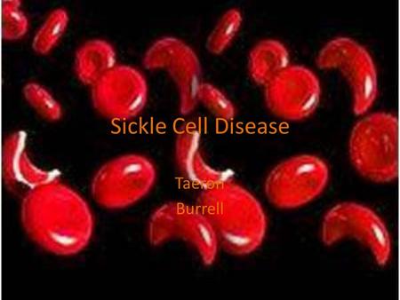 Sickle Cell Disease Taeron Burrell. What Is Sickle Cell Anemia? Sickle cell Anemia is a serious disorder in which the body makes sickle shape blood cells.