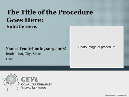 The Title of the Procedure Goes Here: Subtitle Here. Photo/Image of procedure Name of contributing surgeon(s) Institution, City, State Date.