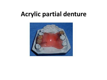 Acrylic partial denture