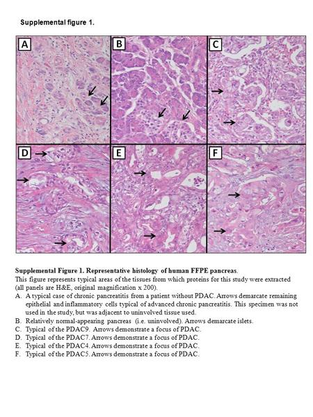 Supplemental figure 1. Supplemental Figure 1. Representative histology of human FFPE pancreas. This figure represents typical areas of the tissues from.