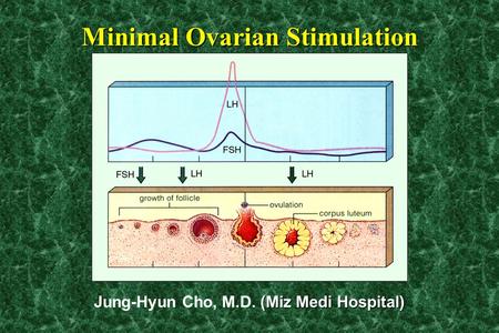 (Miz Medi Hospital) Jung-Hyun Cho, M.D. (Miz Medi Hospital) Minimal Ovarian Stimulation.