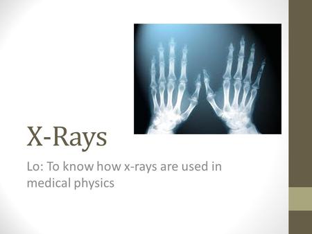 X-Rays Lo: To know how x-rays are used in medical physics.