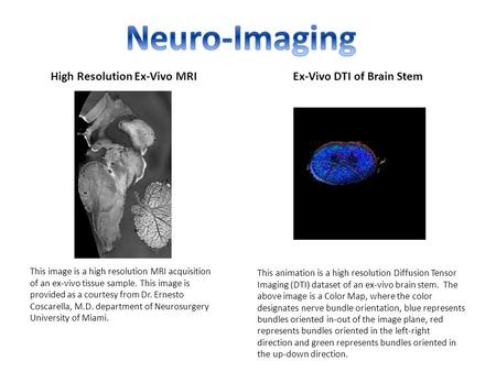 Neuro-Imaging High Resolution Ex-Vivo MRI Ex-Vivo DTI of Brain Stem