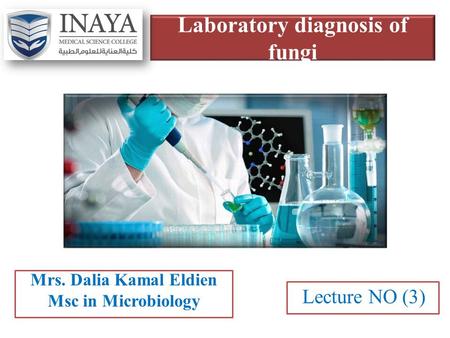 Laboratory diagnosis of fungi