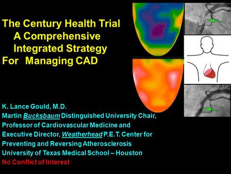 The Century Health Trial A Comprehensive Integrated Strategy For Managing CAD K. Lance Gould, M.D. Martin Bucksbaum Distinguished University Chair, Professor.