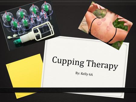 Cupping Therapy By: Kelly 6A.