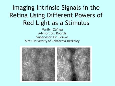 Marilyn Zúñiga Advisor: Dr. Roorda Supervisor: Dr. Grieve Site: University of California-Berkeley Imaging Intrinsic Signals in the Retina Using Different.