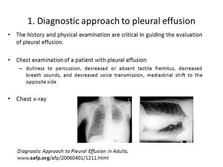 The history and physical examination are critical in guiding the evaluation of pleural effusion. Chest examination of a patient with pleural effusion –