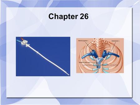 Chapter 26. Dialysis PD vs HD 300,000 patients in the US on HD Destination therapy for most patients Increasing rates of DM and HTN in the US Upper extremity.