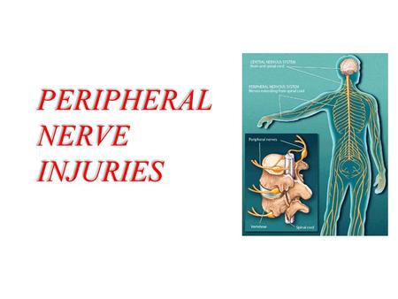 PERIPHERAL NERVE INJURIES