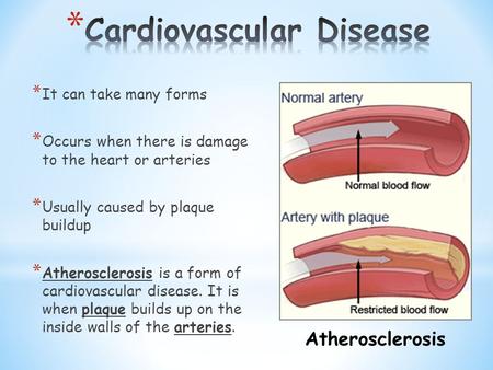 * It can take many forms * Occurs when there is damage to the heart or arteries * Usually caused by plaque buildup * Atherosclerosis is a form of cardiovascular.