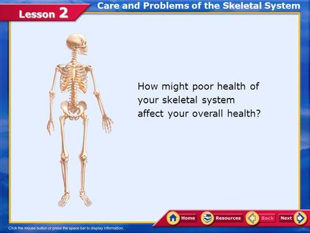 Lesson 2 How might poor health of your skeletal system affect your overall health? Care and Problems of the Skeletal System.